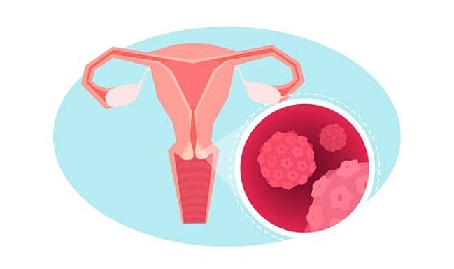 Dr. Sharrón Manuel and Dr. Mabel Lee Featured in a Bored Panda Article Discussing Ovarian Cancer