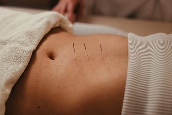 Dr. Natalia Llarena Featured in HealthCentral Article Discussing Acupuncture For Endometriosis