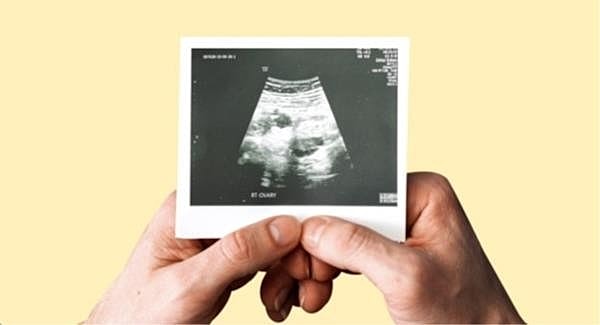 The Men’s Guide to Infertility