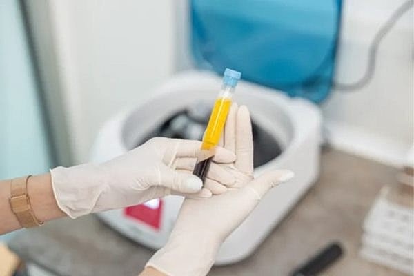 Will Platelet-Rich Plasma Treatment Increase My Odds Of Success With IVF?
