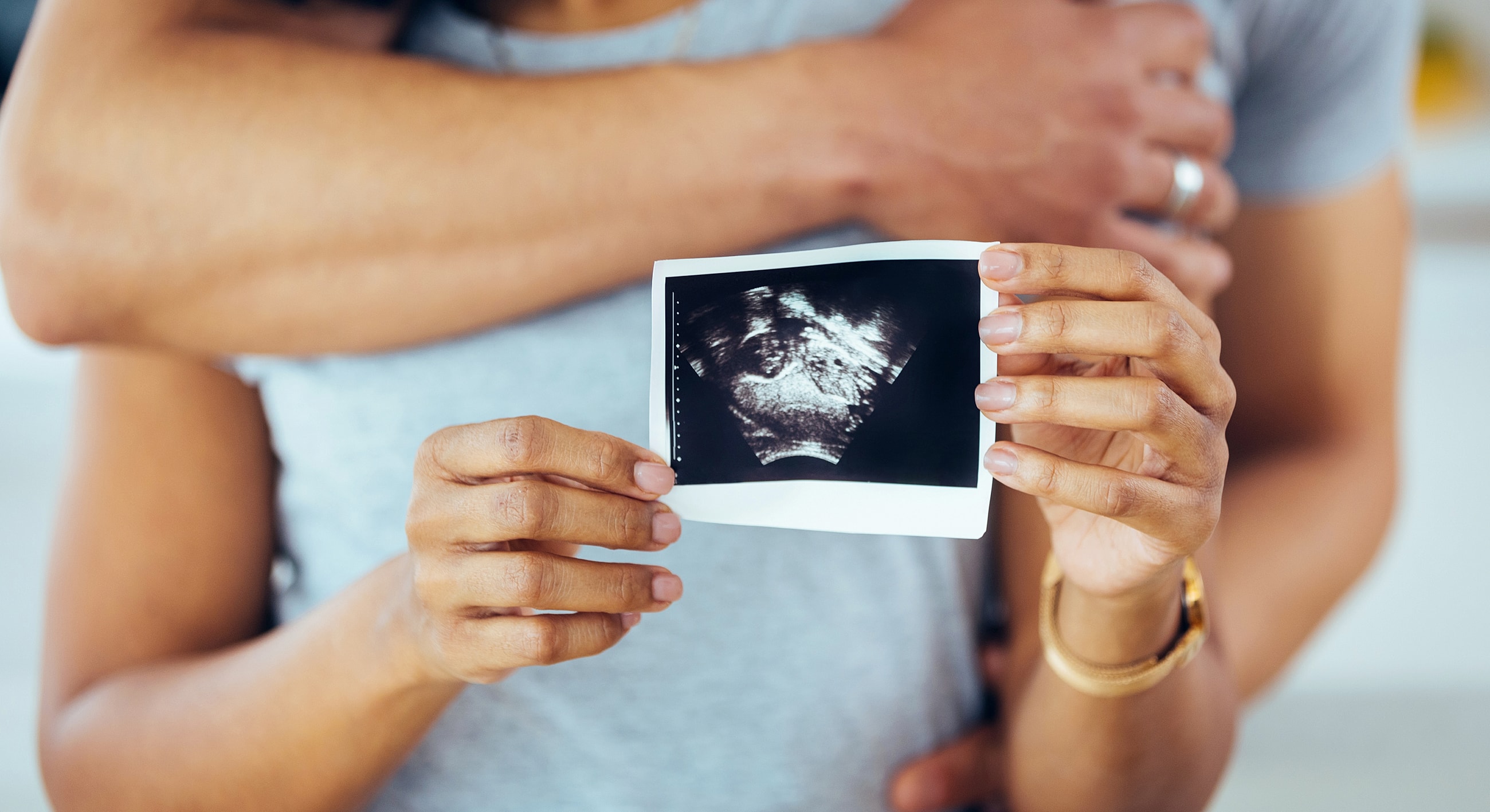 Couple holding an ultrasound photo together.